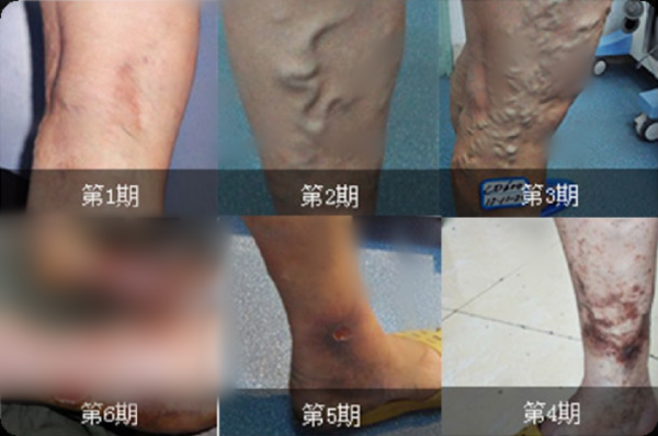 图片 1.png